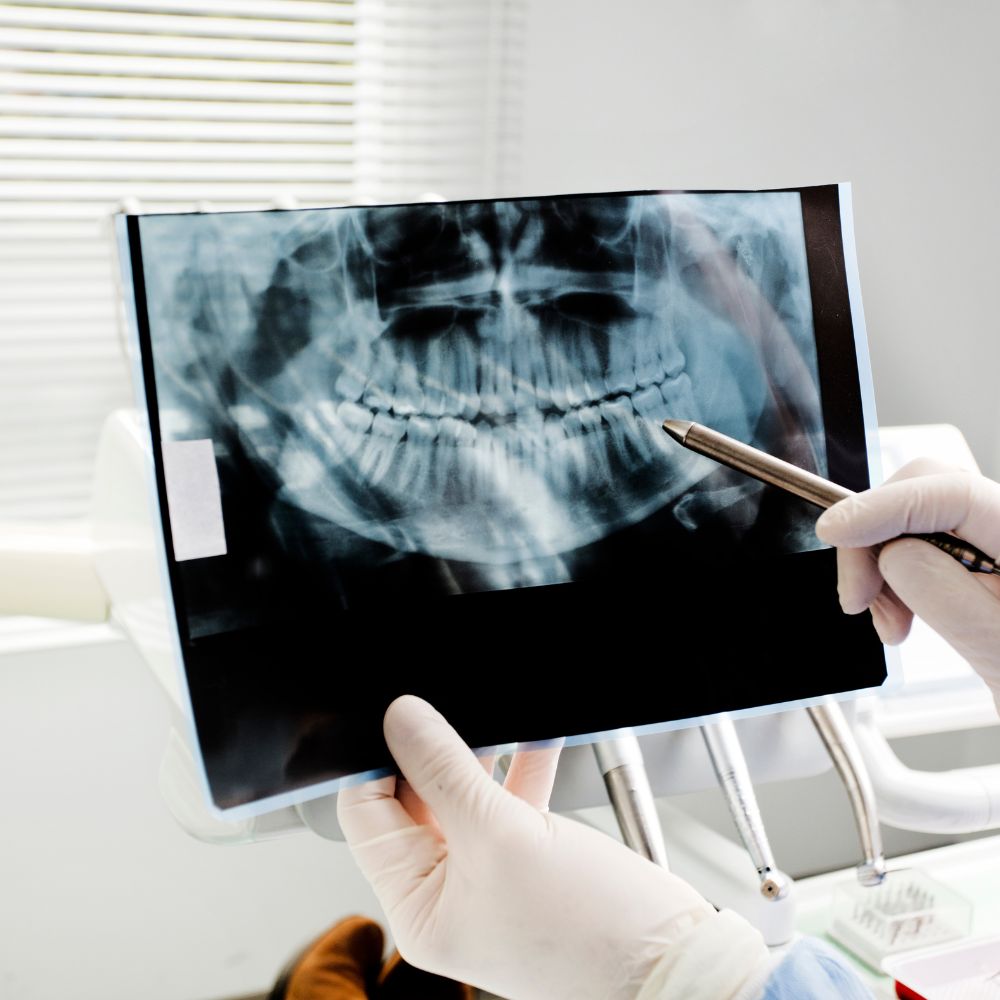 Dental X-Rays
